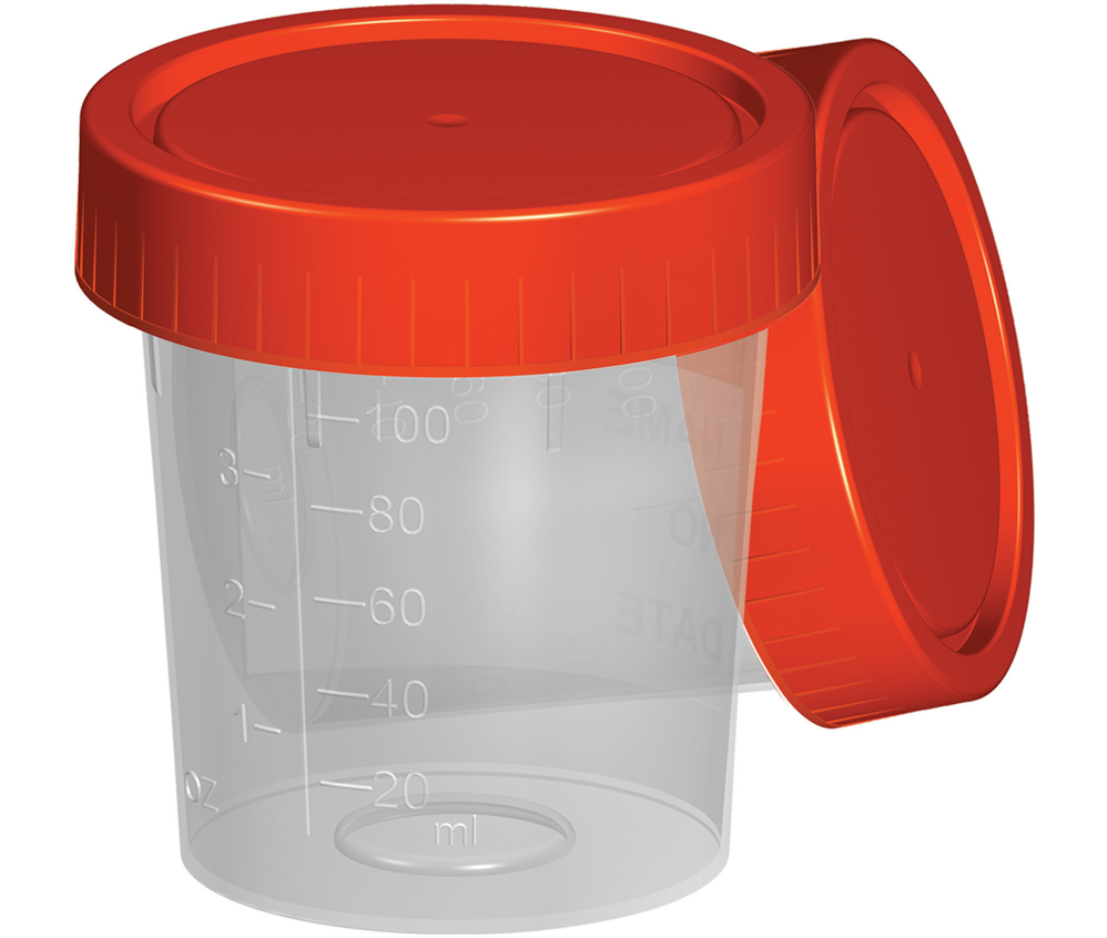 Fıratmed Pnömatik Sistem Steril İdrar Numune Kabı 100 mL – 300 Adet