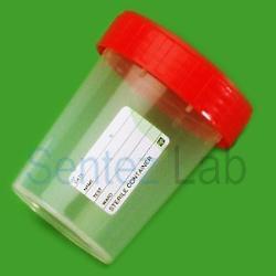 Lp Italiana Numune Kabı Plastik PP Hacim 180 ml Steril Etiketli 25 Adet