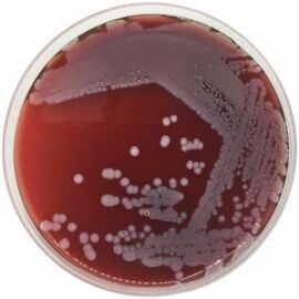 Condalab 1108 Blood Agar Base 500g