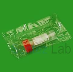 Numune Kabı Hacim 25 ml Kaşıklı Steril Etiketli Tek Tek Poşetli 50 Adet