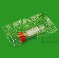 Numune Kabı Hacim 25 ml Kaşıklı Steril Etiketli Tek Tek Poşetli 50 Adet