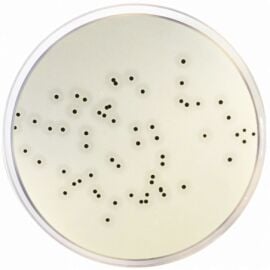 Condalab 1100 Baird Parker Agar Base Eur. Pharma. 500 grams