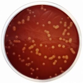 Condalab 1048 Brain Heart Infusion Agar (B.H.I. Agar) 500 grams